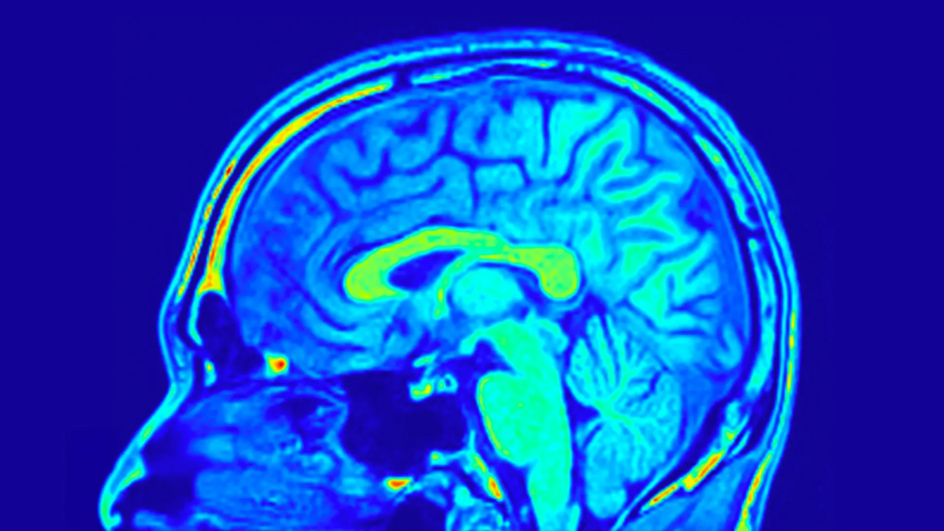 human brain mri colorful sagital slice