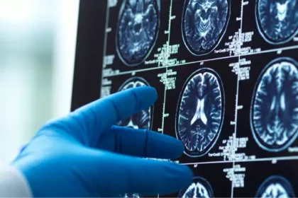 brain scans