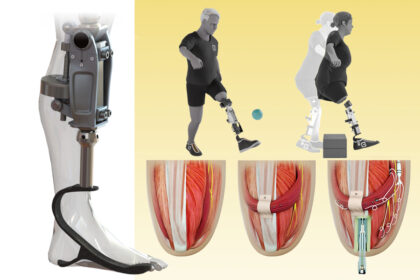 MIT Bionic Knee 01 press 0