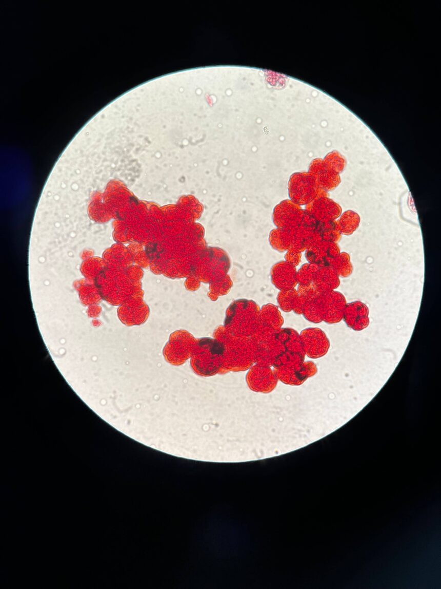 Scientists Discover Genetic Switch That Supercharges Cancer-Killing Immune Cells 1 pexels leonie vogler 2147983217 29859866 1