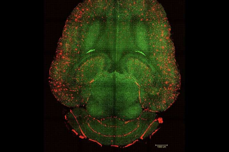 scientists reverse alz